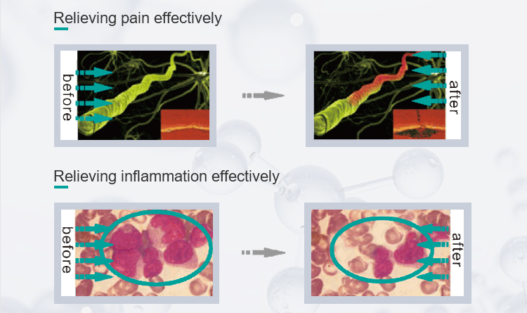 laser pain relief machine