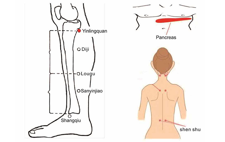 diabetic foot care products