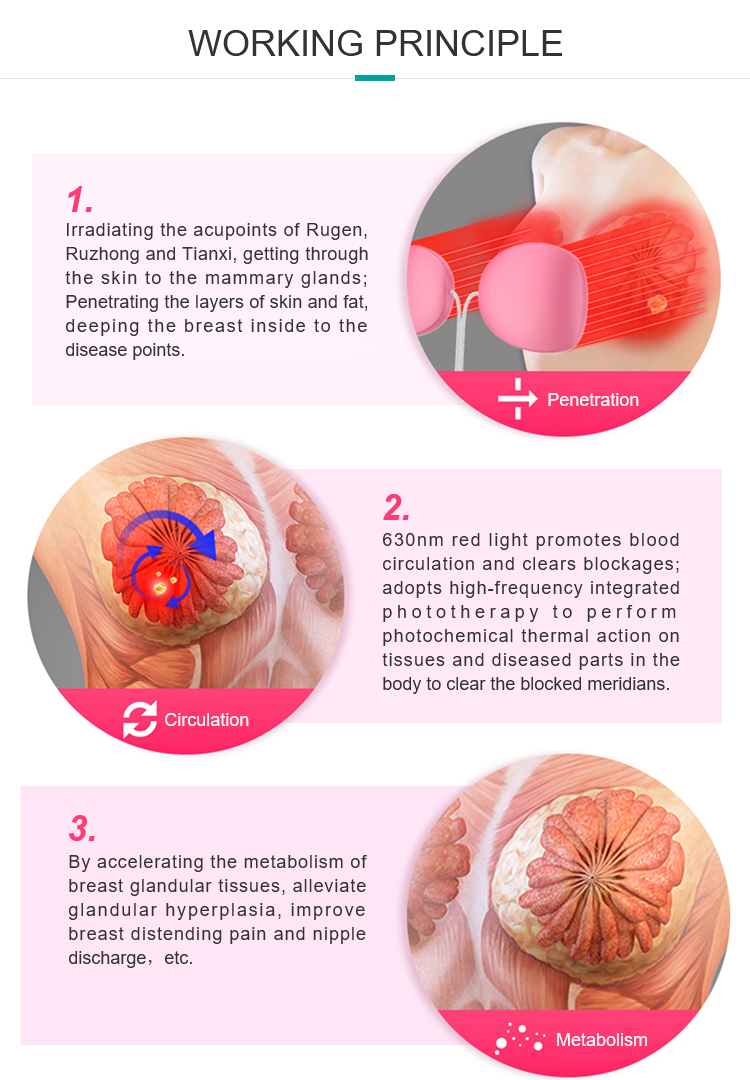 Breast fibroadenoma Areola