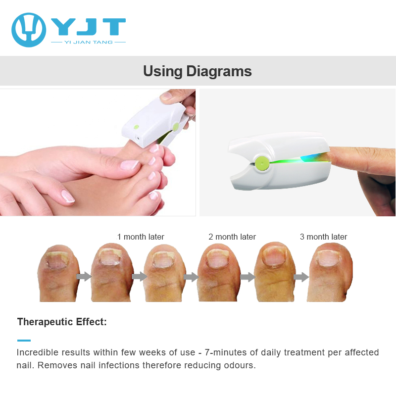 laser therapy