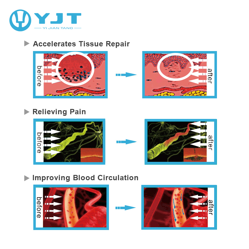 lasertherapy