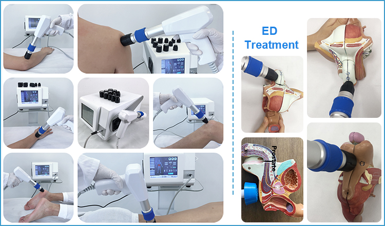 shock wave therapy machine