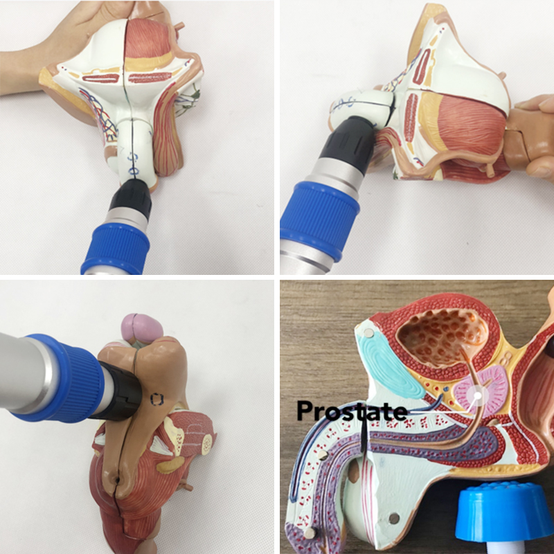 Acheter Équipement de physiothérapie à usage domestique, Machine pneumatique à ondes de choc, traitement Ed, soulagement de la douleur,Équipement de physiothérapie à usage domestique, Machine pneumatique à ondes de choc, traitement Ed, soulagement de la douleur Prix,Équipement de physiothérapie à usage domestique, Machine pneumatique à ondes de choc, traitement Ed, soulagement de la douleur Marques,Équipement de physiothérapie à usage domestique, Machine pneumatique à ondes de choc, traitement Ed, soulagement de la douleur Fabricant,Équipement de physiothérapie à usage domestique, Machine pneumatique à ondes de choc, traitement Ed, soulagement de la douleur Quotes,Équipement de physiothérapie à usage domestique, Machine pneumatique à ondes de choc, traitement Ed, soulagement de la douleur Société,