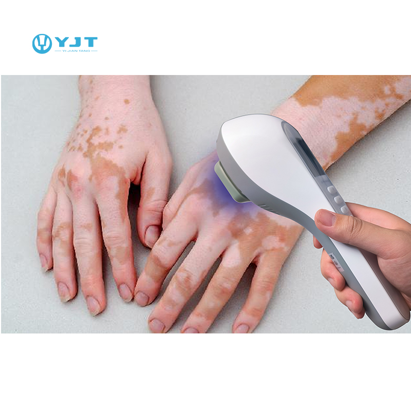 Acheter Appareil de luminothérapie UVB pour le vitiligo,Appareil de luminothérapie UVB pour le vitiligo Prix,Appareil de luminothérapie UVB pour le vitiligo Marques,Appareil de luminothérapie UVB pour le vitiligo Fabricant,Appareil de luminothérapie UVB pour le vitiligo Quotes,Appareil de luminothérapie UVB pour le vitiligo Société,