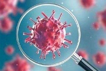 Endogener Mangel an Glutathion als wahrscheinlichste Ursache für schwerwiegende Manifestationen und den Tod durch eine neuartige Coronavirus-Infektion (COVID-19)