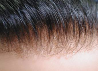 ALL French Lace Hair Replacement System For Men