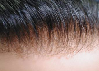 Einzigartiges entworfenes Poly-Back-Haarersatzsystem mit Spitzefront