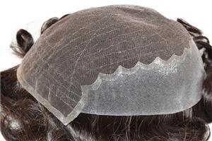 Sistema projetado original da substituição do cabelo da parte traseira da parte dianteira do laço