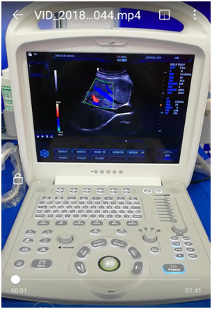 ultrasound machine portable