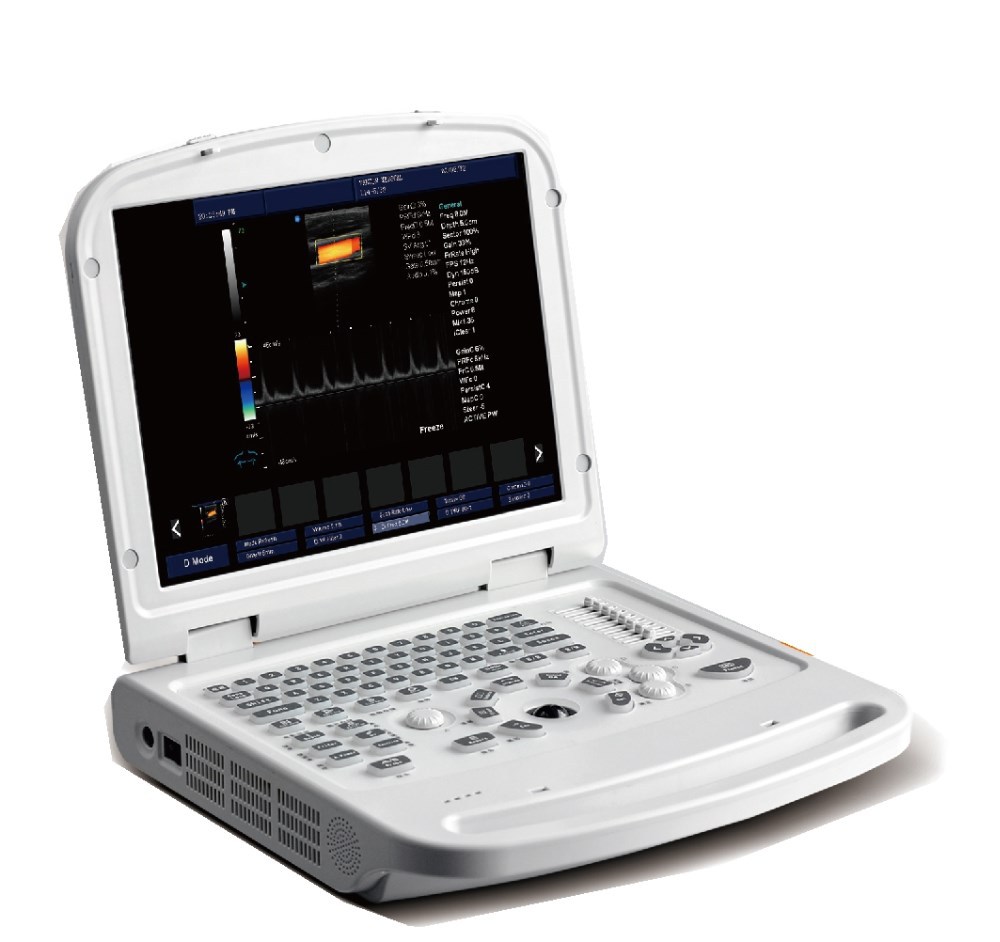 4d ultrasound machine