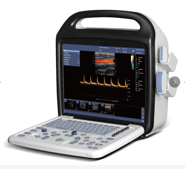 portable color doppler ultrasound system