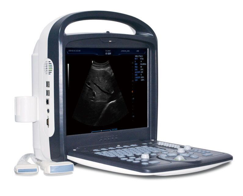 3d/4d ultrasound