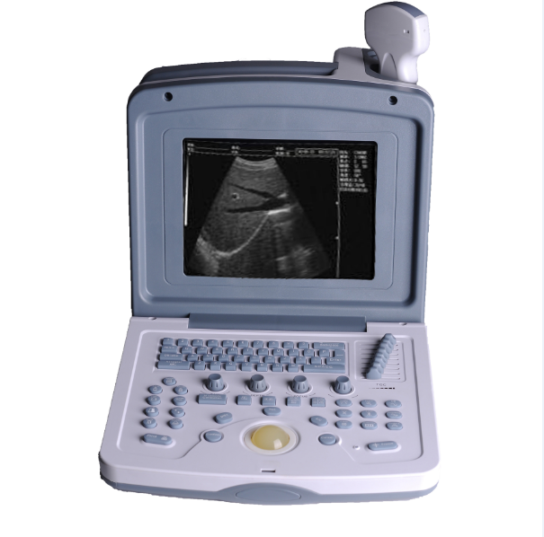 portable ultrasound