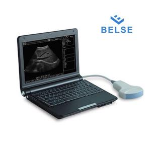 Prix du scanner à ultrasons portable