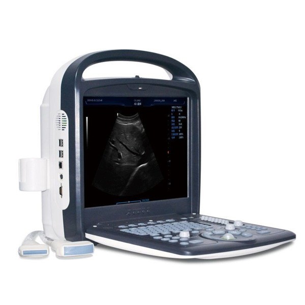 Máquina veterinaria del ultrasonido de Doppler del color 4D para la prueba de embarazo