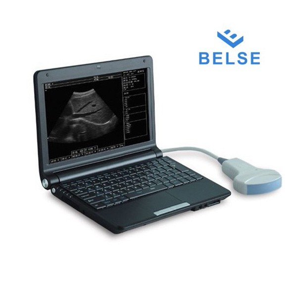 Mesin Ultrasonografi Veteriner Laptop