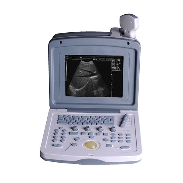 Tagagawa ng Portable Ultrasound
