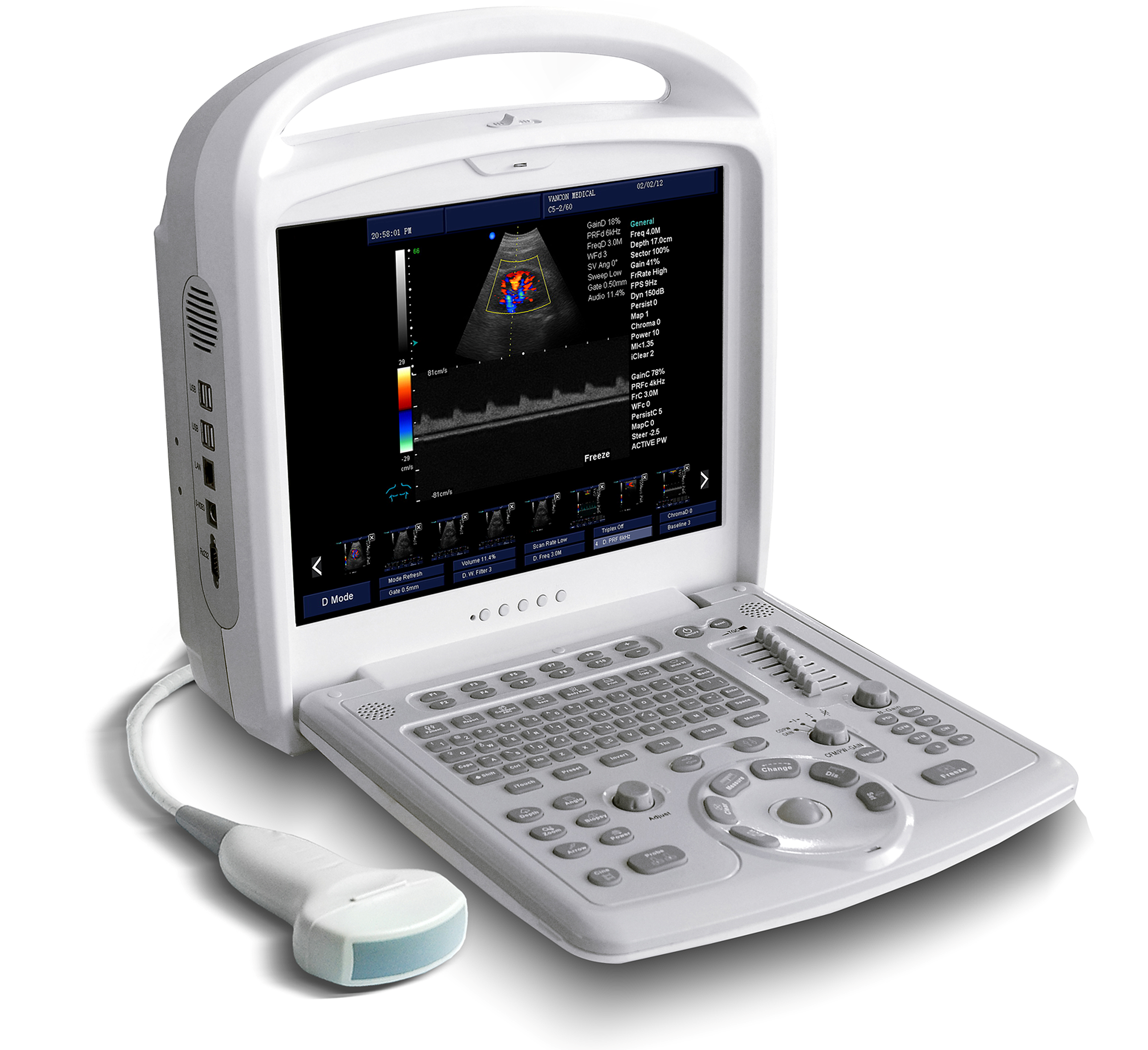 Full-Digital Black And White Ultrasound
