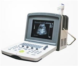China manufacturer price portable ultrasound machine