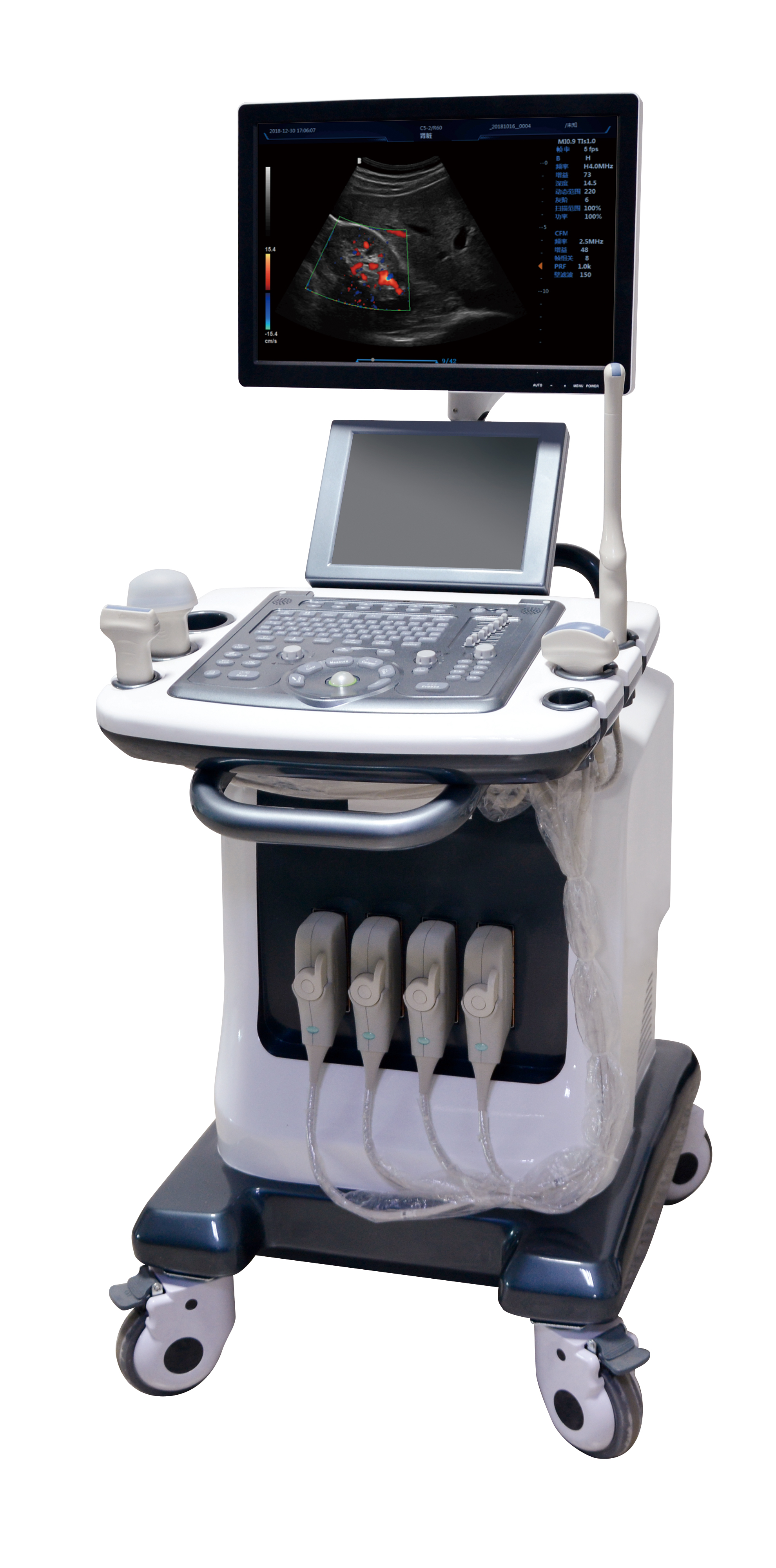 Trolley color doppler ultrasound scanner at medical use color ultrasound