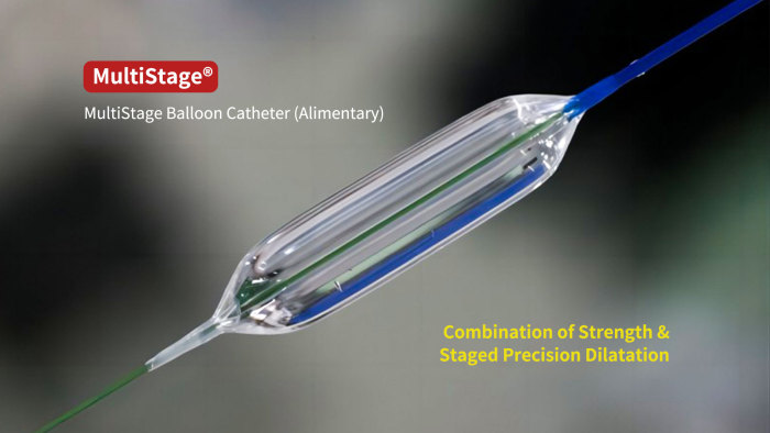 MultiStage Balloon Catheter (Alimentary).