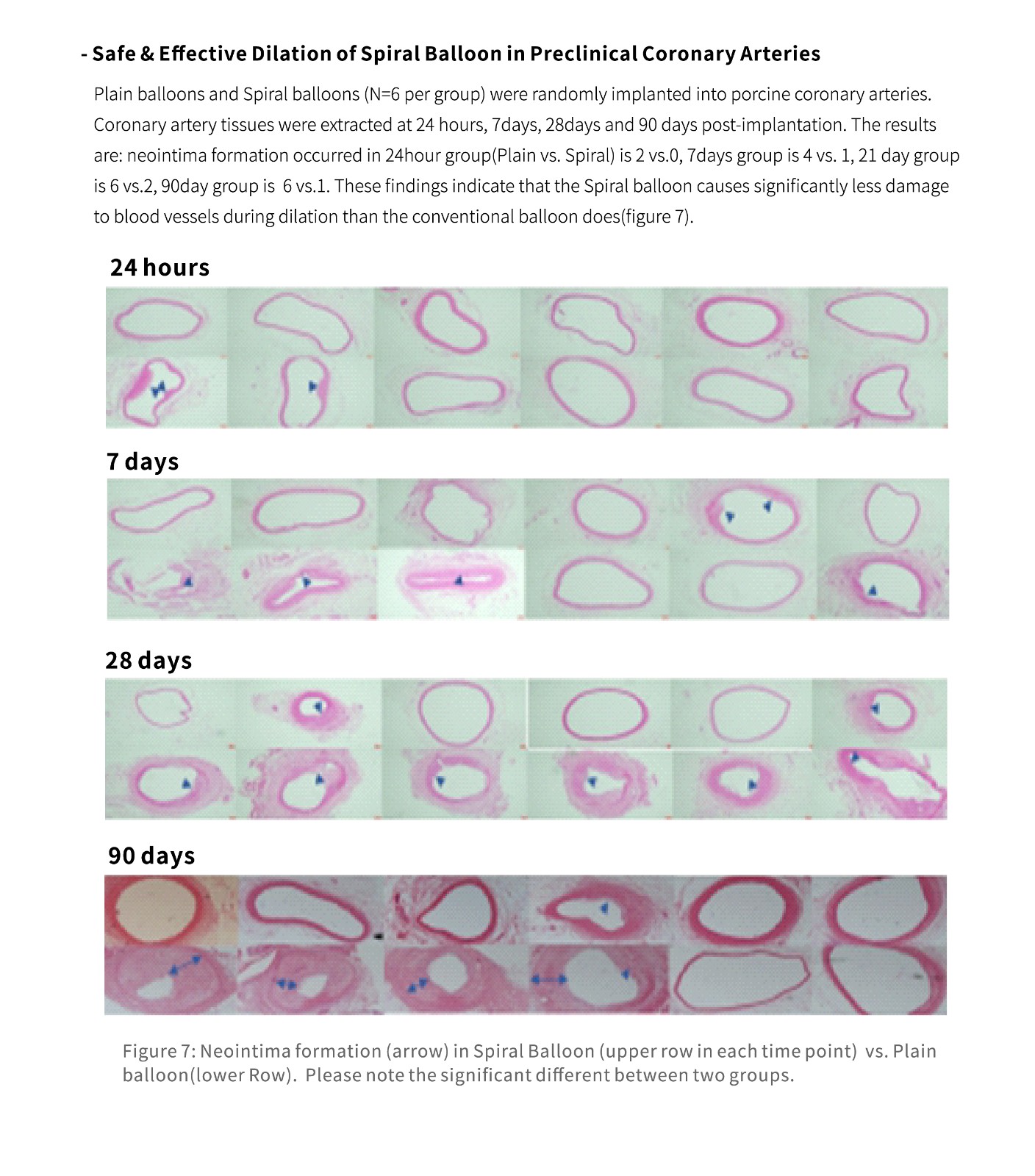 Cardiac Interventions catheter