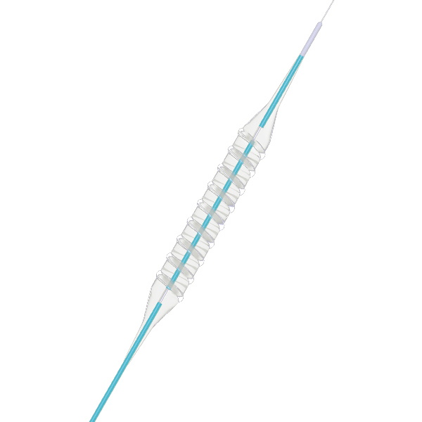 VesSpiral® 旋刻®螺纹球囊扩张导管
