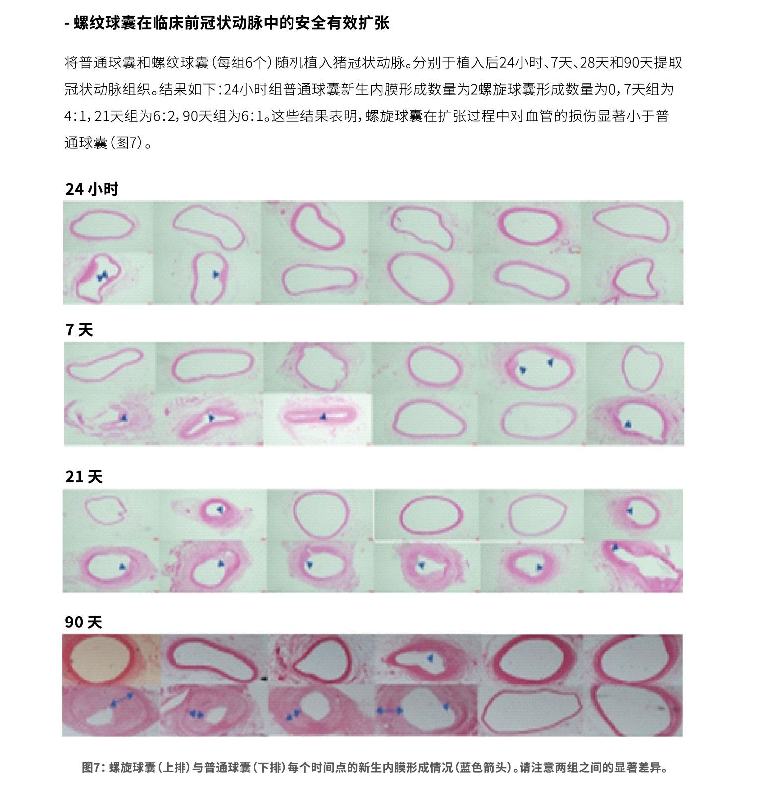 螺纹