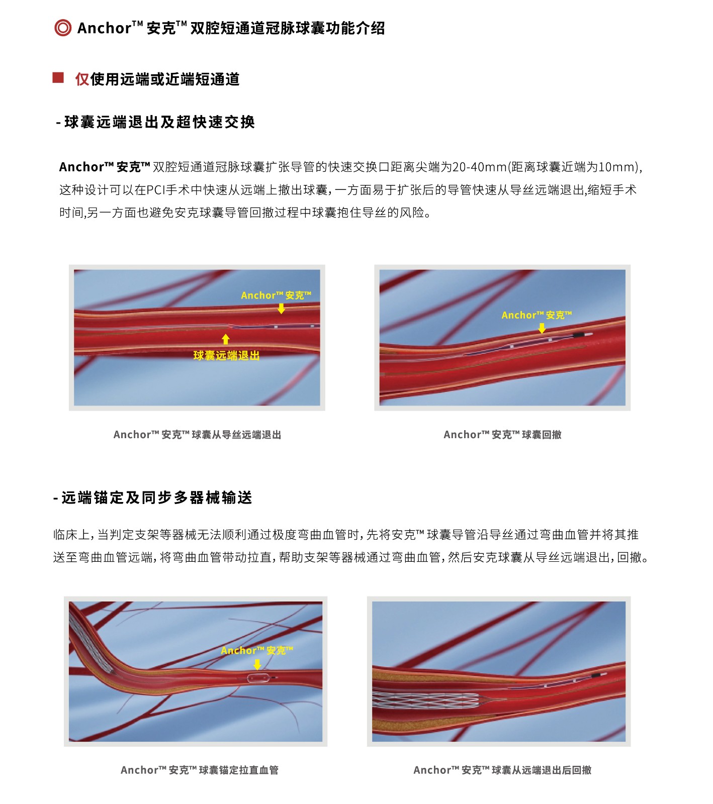 球囊