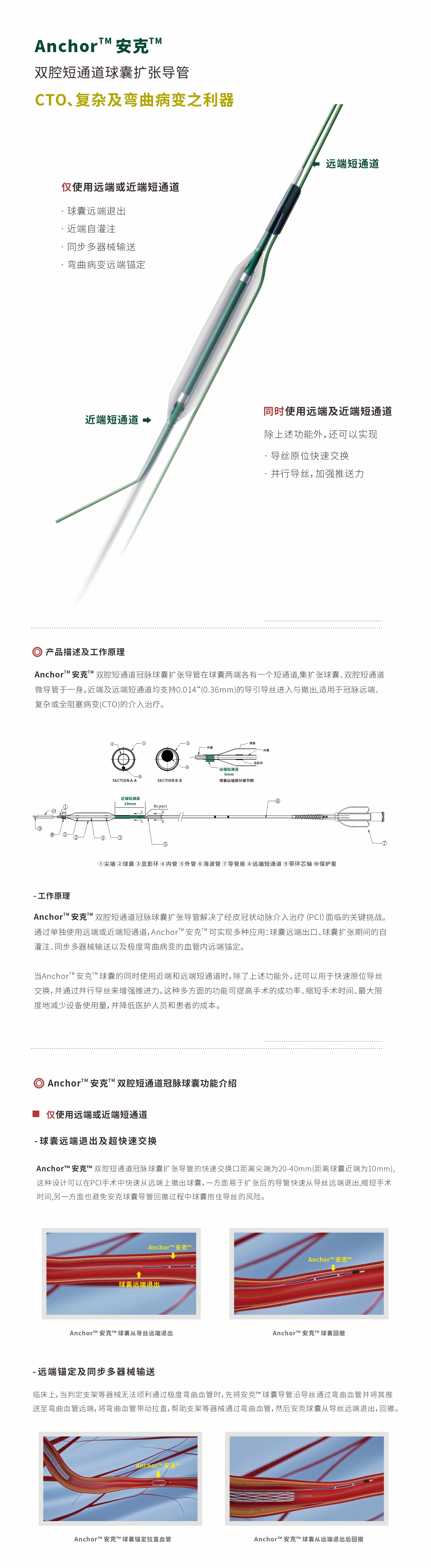 介入治疗 介入治疗