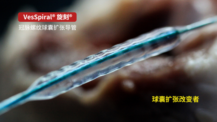 VesSpiral®旋刻®螺纹球囊扩张导管