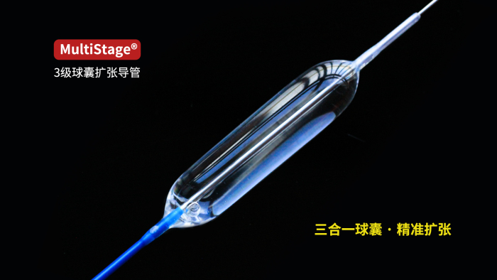 MultiStage® 3级球囊扩张导管