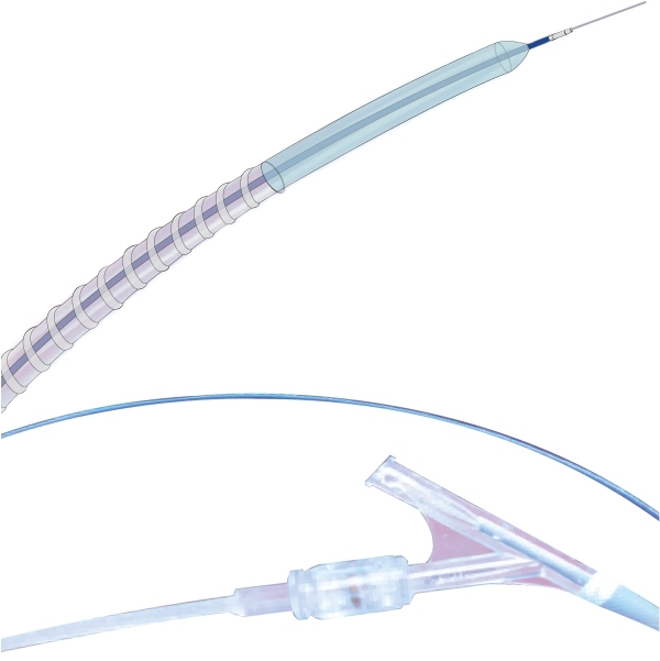 PeriUltra™ PTA Spiral Twin-Wall High Pressure Balloon Dilatation Catheter
