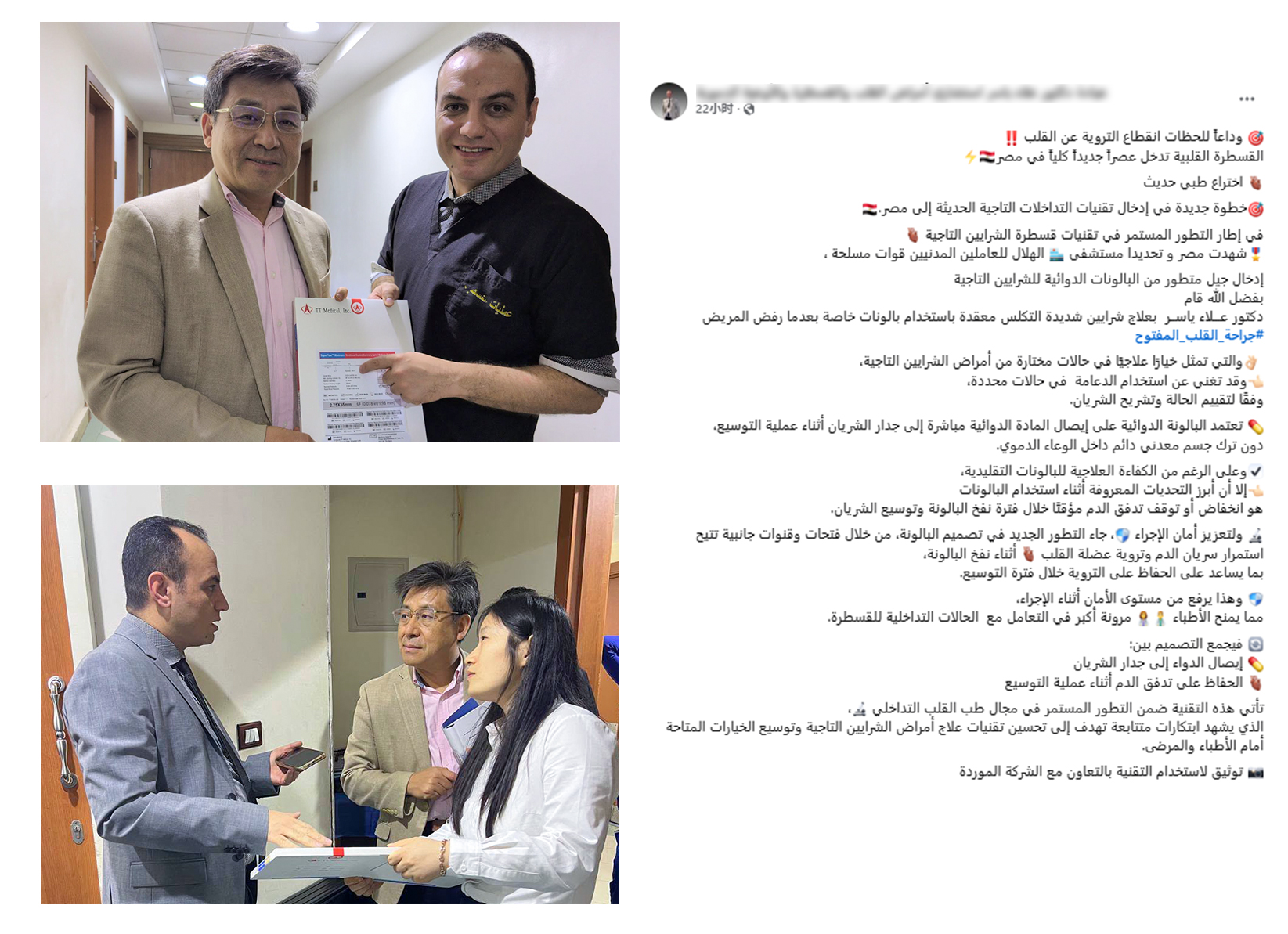 PTCA Balloon Catheter PTCA Balloon Catheter