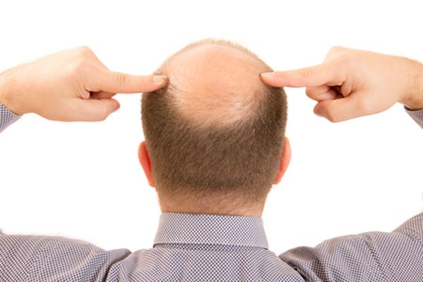 anti-hair loss