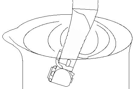 20:1 conra angle