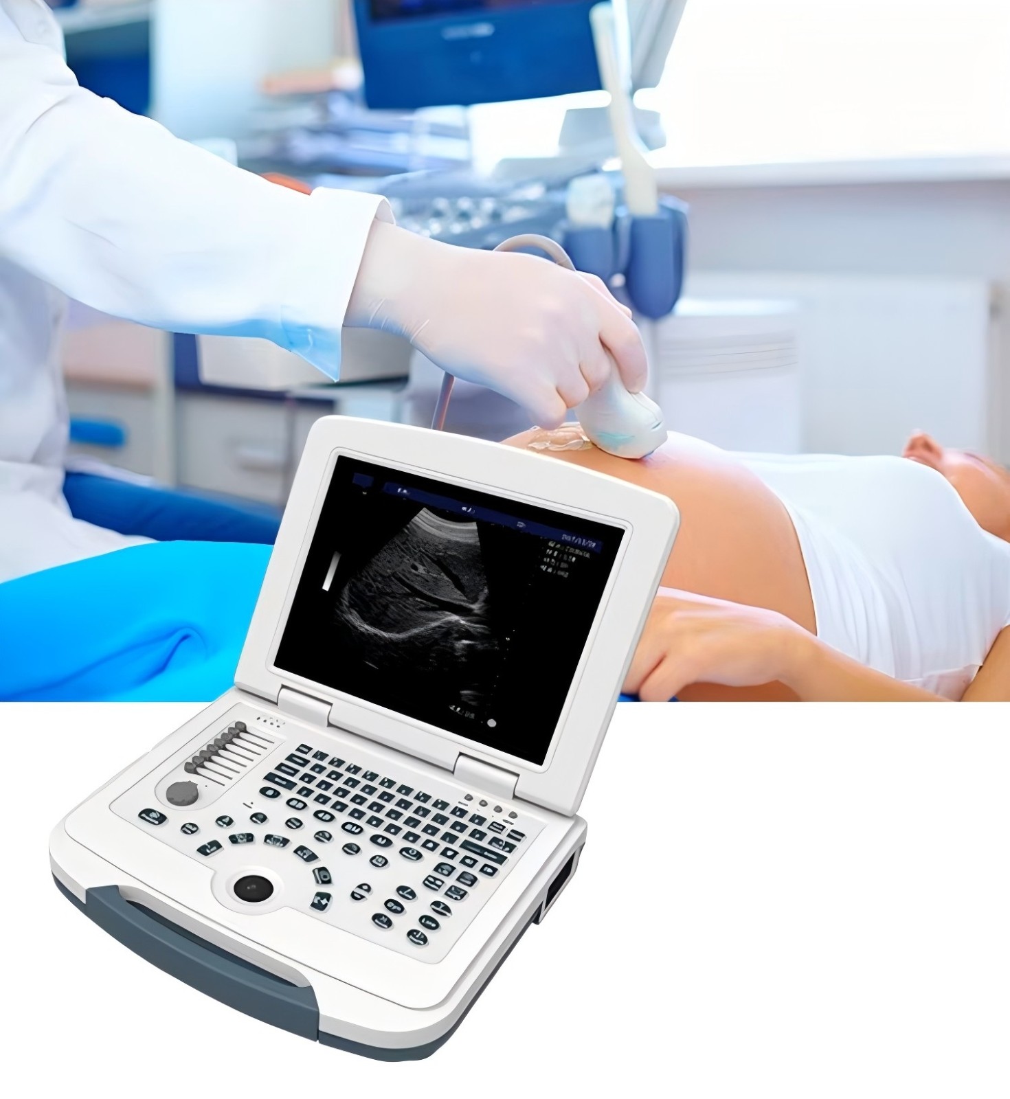 Ultrasound Scanne