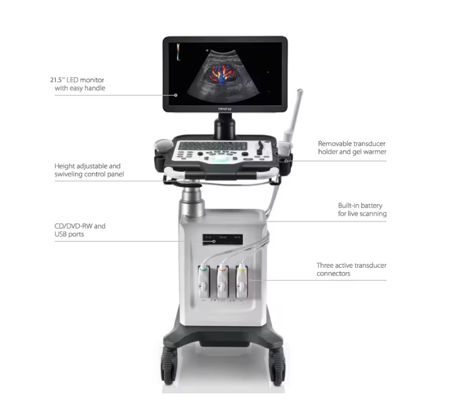 Wireless Ultrasound Probe