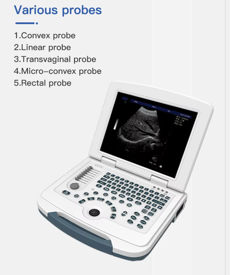 Portable Ultrasound