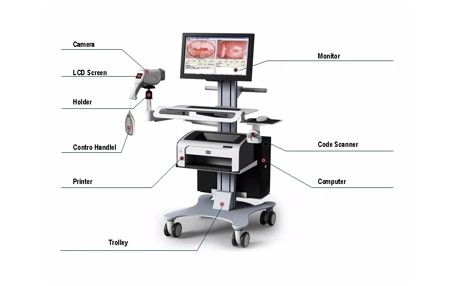 Colposcope For Gynecology