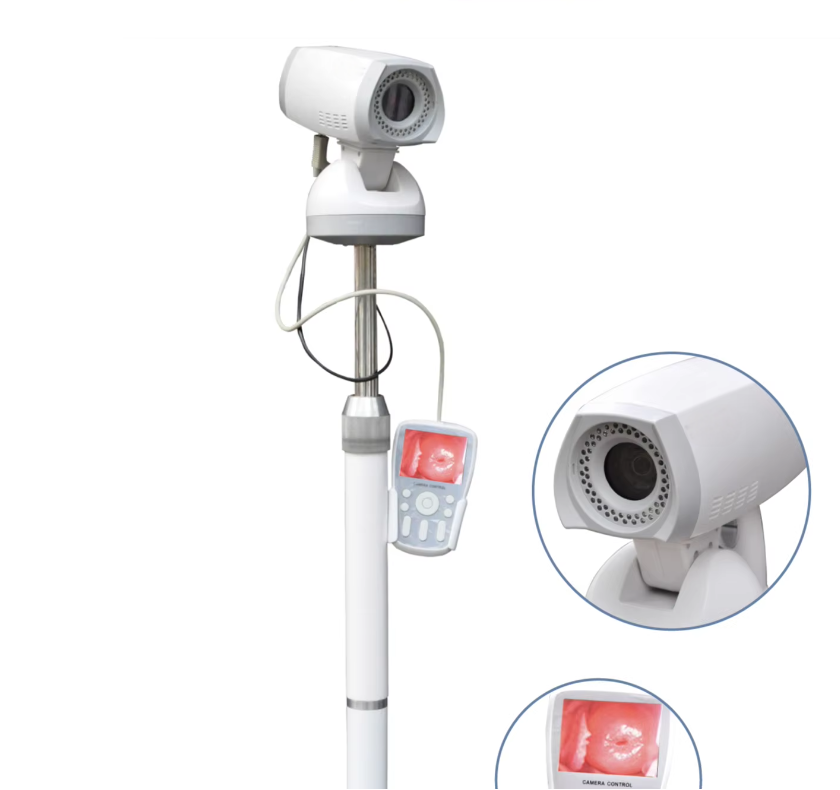 Medical Colposcope Device