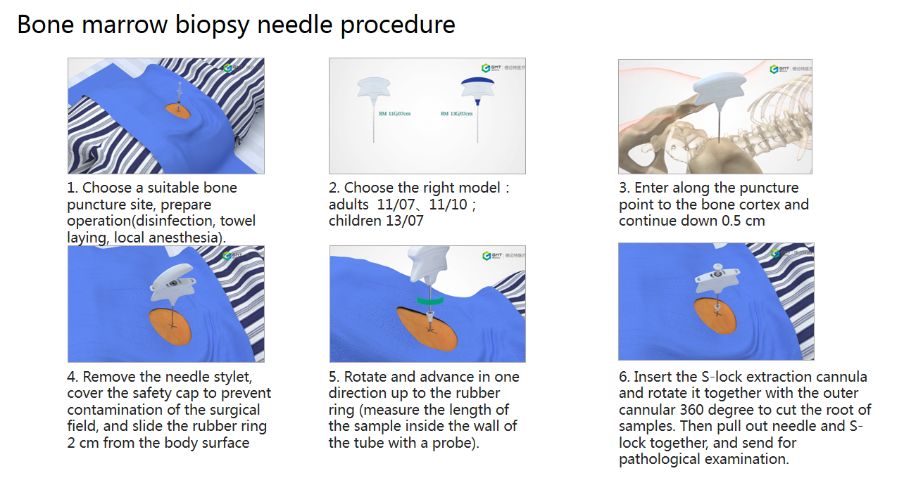 bone biopsy needle