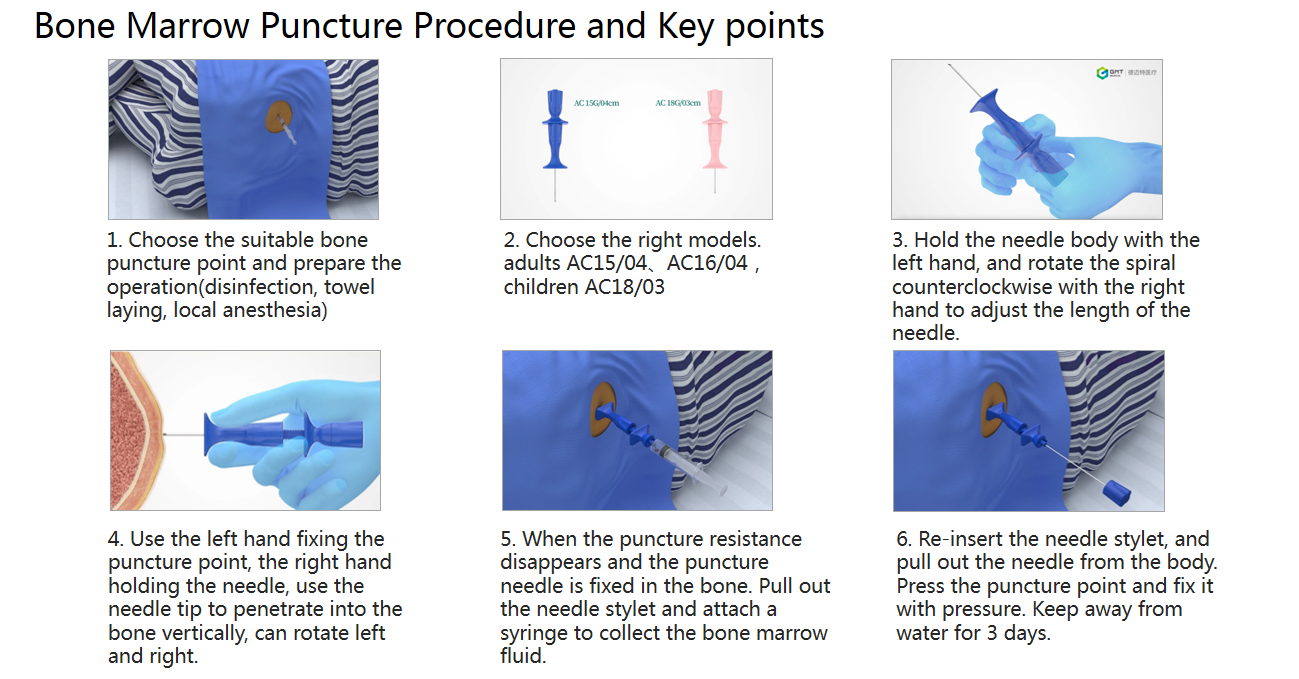 bone biopsy needle