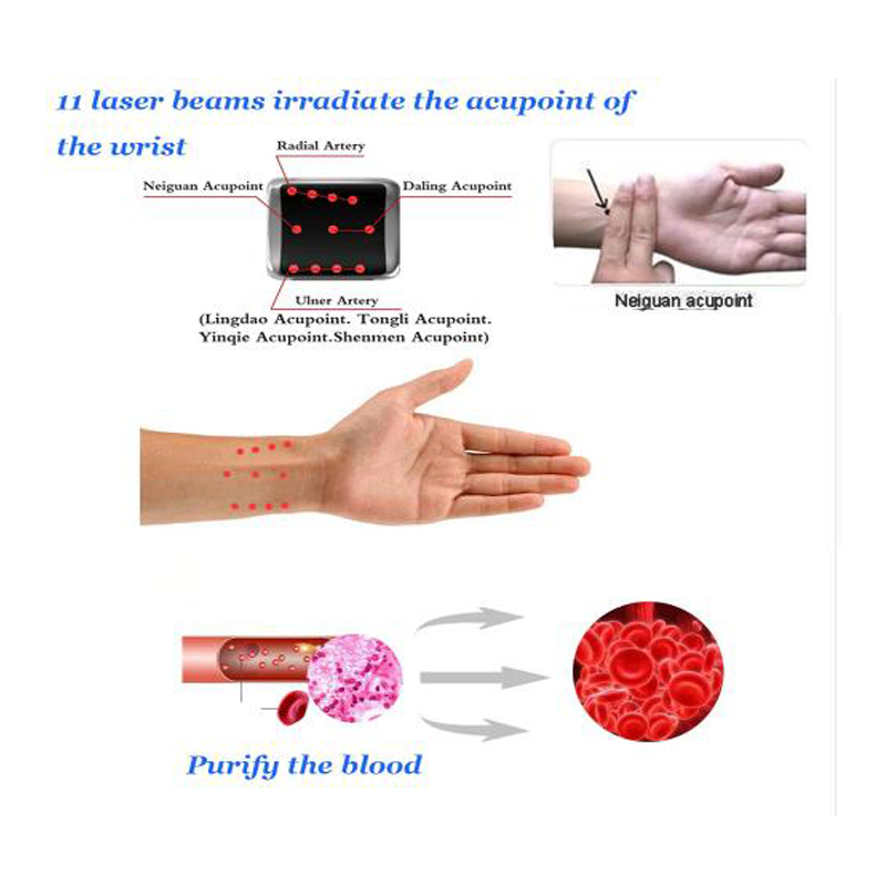 Factory Offer Laser Digital Blood Glucose Watch