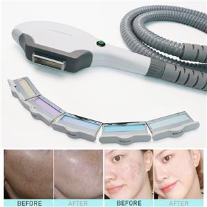 Laser Hair Removal Recommendation 3 In 1 Diode Laser+IPL+Nd YAG