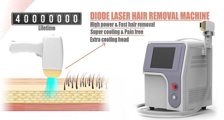 laser hair removal system