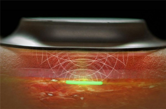 Sensor de presión capacitivo portátil para la recogida de señales fisiológicas humanas