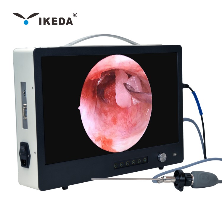 1080P Telecamera per endoterapia/endoscopia Dispositivi per reparto di urologia