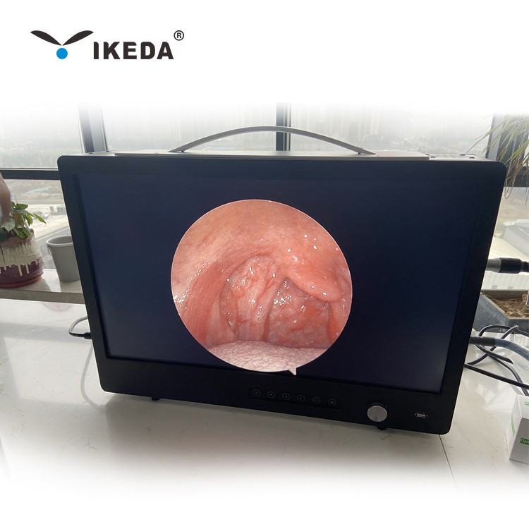 1080P Endotherapy /endoscopy camera Devices for urology department
