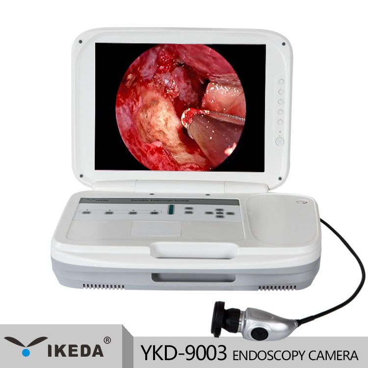 Tragbare Endoskopiekamera All-in-One-Endoskopiekamera 1080p-Endoskopiekamera